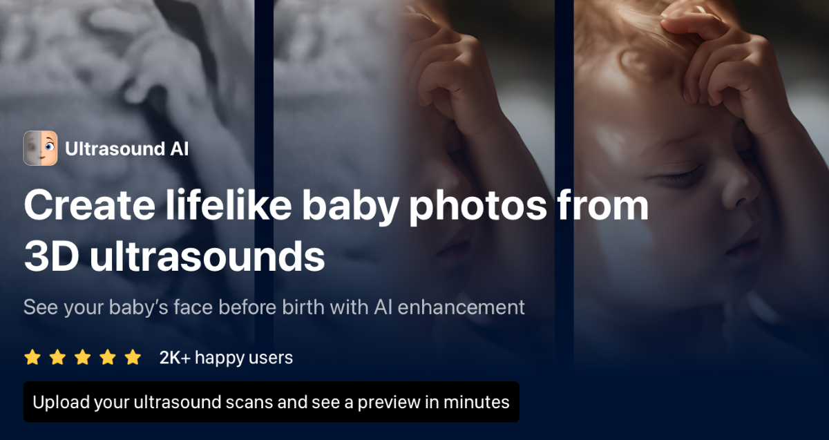 Ultrasound AI product image